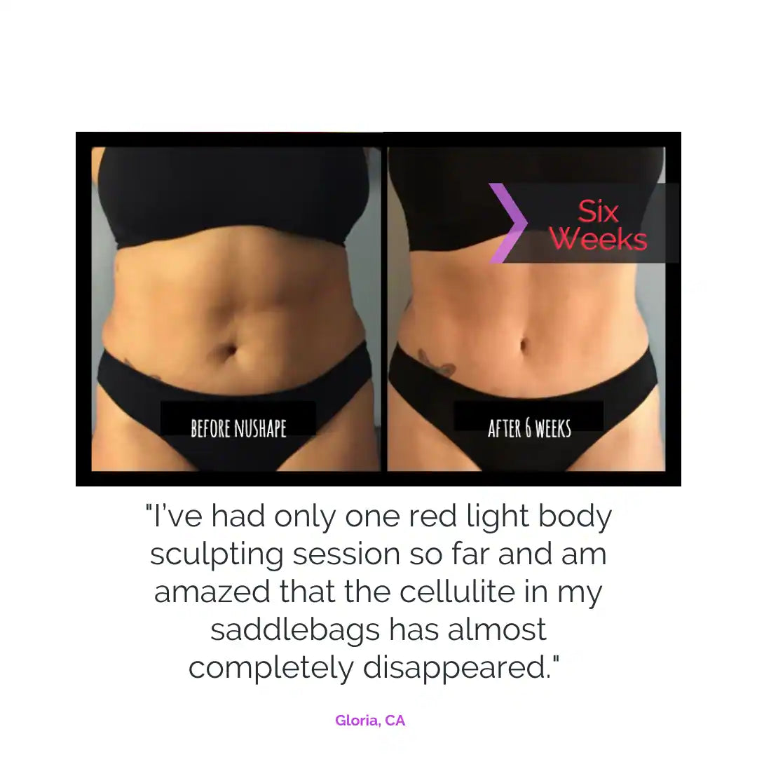 Nushape Lipo Wrap Before & After Result